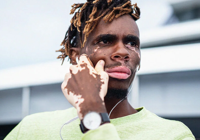  World Vitiligo Day Spreading Blis